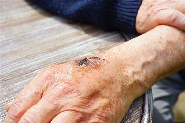 梦见被砍伤是什么意思 梦见被砍伤是什么意思