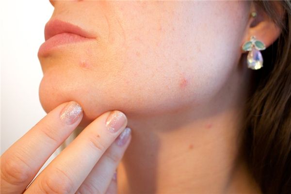 梦见疖子是什么意思 梦见疖子是什么意思