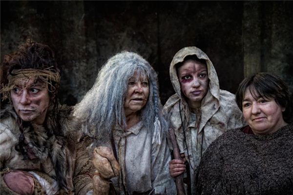 梦见麻疯病是什么意思 梦见麻疯病是什么意思